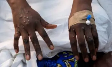 Sierra Leone Reports First Confirmed Case of Mpox