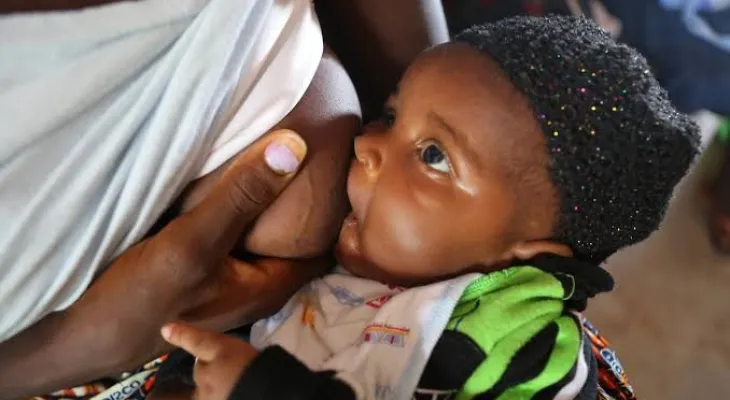 ChildFund Sierra Leone Warns Public About Fake Breastfeeding Workshop
