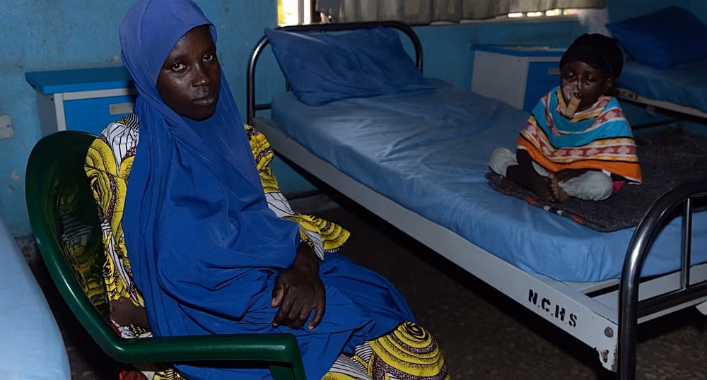 Child receiving treatment for noma at a specialist hospital in Sokoto, Nigeria